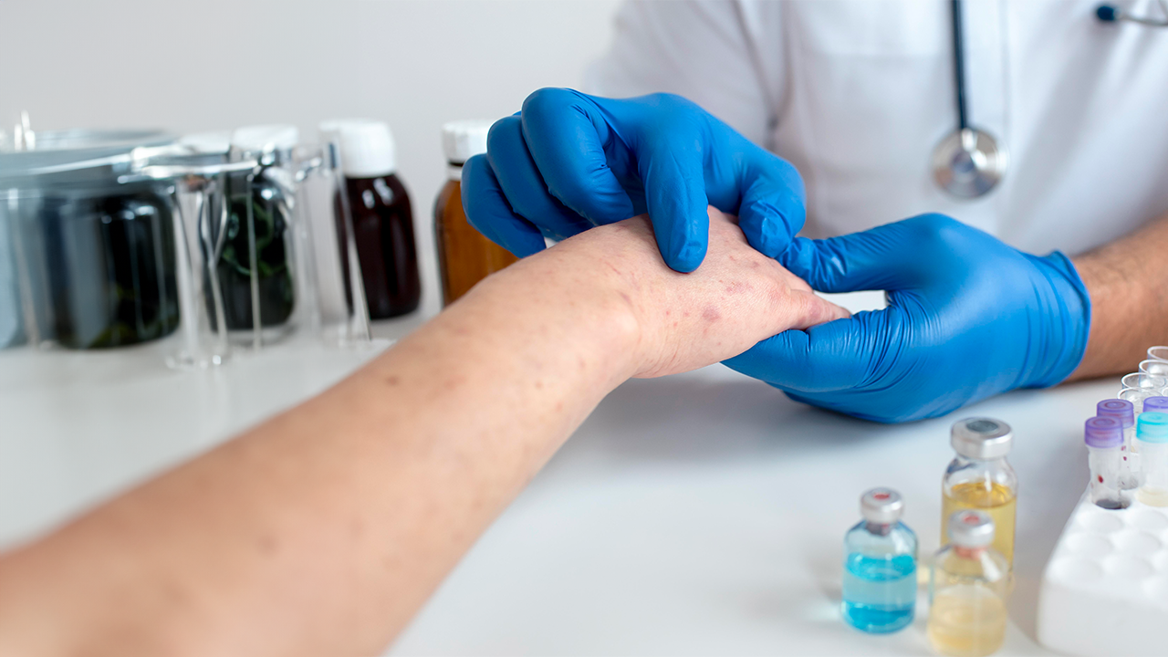 Alergia e Imunologia