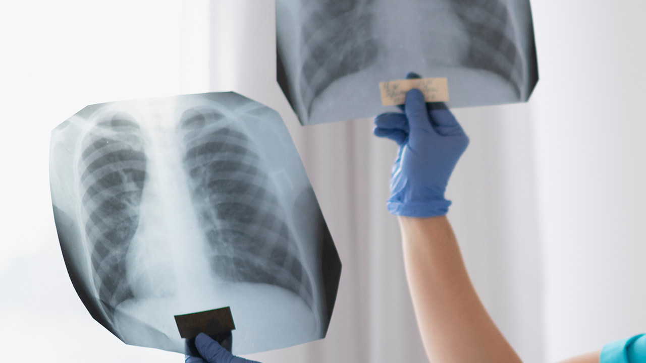 Pneumologia