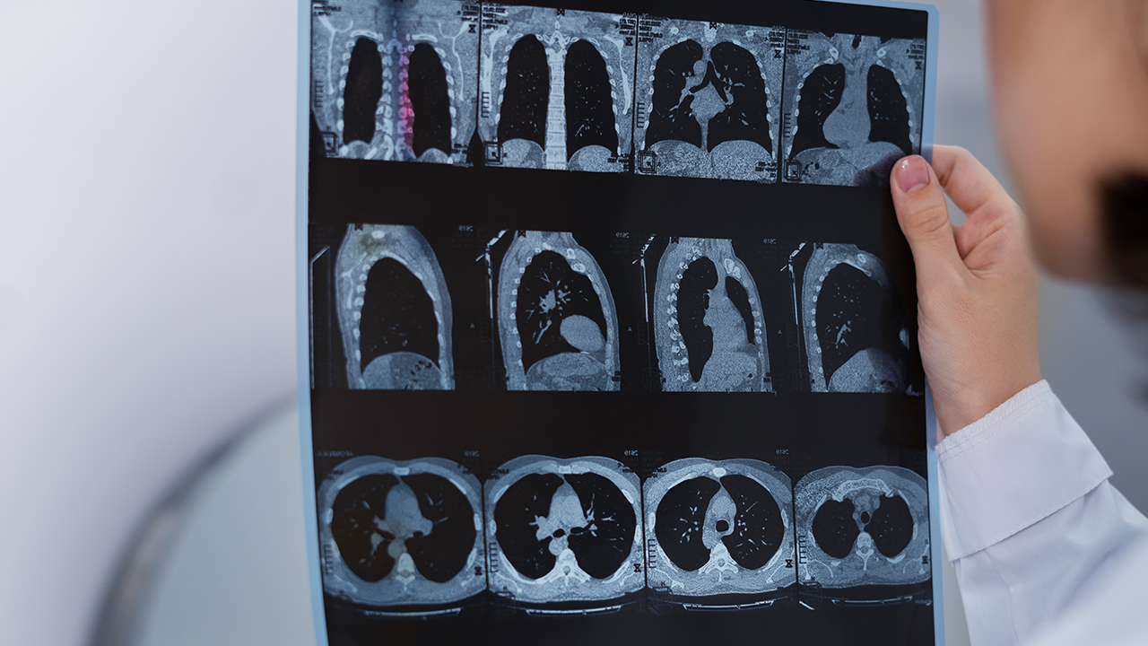 Radiologia